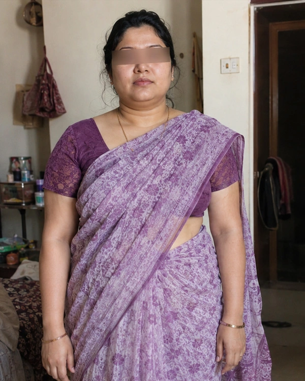 Hypothyroidism care before result